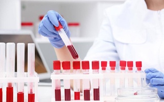 Медиков, работающих с кровью и ее компонентами, вакцинируют