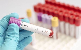 В Узбекистане рассматривают введение обязательного ВИЧ-тестирования для вернувшихся из-за рубежа граждан