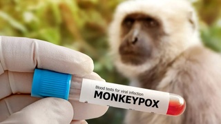 Вирус оспы обезьян мутирует быстрее, чем ожидалось