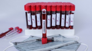 Qozogʻistonda koronavirusga qarshi birinchi emlash amalga oshirildi