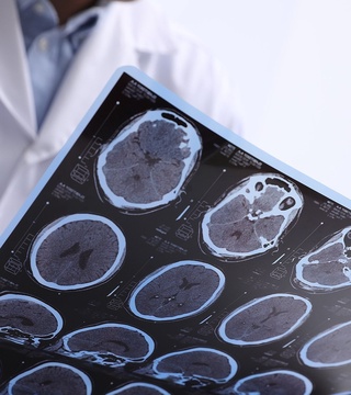 Миянинг энг аниқ МРТ тасвирлари олинди