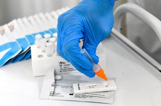 Кетма-кет икки кунлик кескин пасайиш динамикасидан сўнг дунёда касалланишлар сони яна ортди