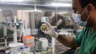 JSST: Vabo kasalligi aniqlangan bemorlar soni ortmoqda