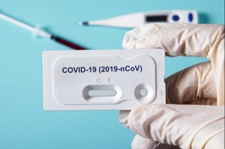 COVID–19 га антитана ва антигенга экспресс тестларни сертификатлаштирмасдан импорт қилишга рухсат берилди