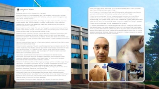 Гумондорларга нисбатан гўёки қийноқлар қўлланилмоқдами?