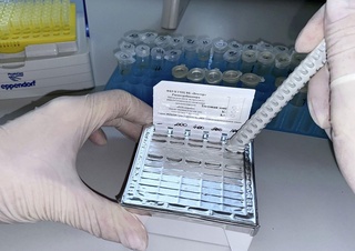 ЖССТ маймун чечаги вирусини аниқлайдиган илк тестни тасдиқлади