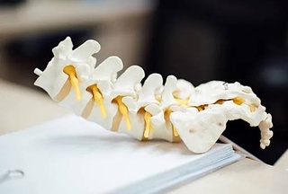 Барои муолиҷаи чурраи байни сутунмӯҳраҳо пластир омода карда шуд