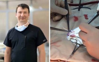 For the first time in Uzbekistan, a unique heart surgery was performed