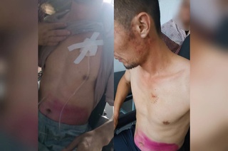 Наманганда фуқарога тан жароҳати етказилиши бўйича жиноят иши қўзғатилди