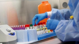 Kecha Oʻzbekistonda 400 nafardan oshiq yangi kasallanish holati qayd etildi