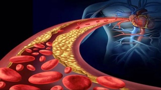 COVID-19 повышает риск нарушений жирового обмена в крови