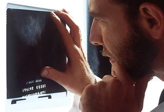 Бош ва бўйин саратони юзага келишининг янги сабаби аниқланди