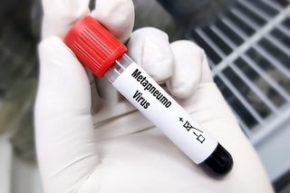 Метапневмовирус жаңа кеселлик емес. Артықша қәўетерге орын жоқ - ДСМ