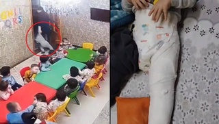 Toshkentdagi bogʻchada bolaning kaltaklanishi sabab oyogʻi sindi