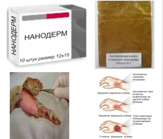 Олимони ӯзбекистонӣ барои муолиҷаи захми трофикӣ ва сӯхтагӣ плёнкаи имплантатҳои биологиро таҳия карданд