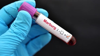 Марбург вирусини олдини олиш мақсадида Ўзбекистон давлат чегарасида Cанитария назорат пунктларининг хушёрлиги оширилмоқда