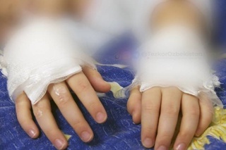 Ona shirinlikni ruxsatsiz yegan bolasining qoʻlini kuydirdi