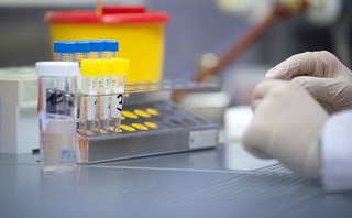 Ҳудудларда етарли миқдорда коронавирусни аниқловчи тест-тизимлар мавжудми?