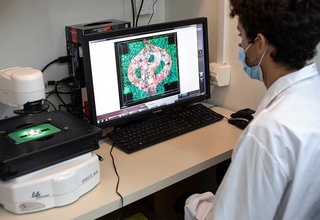 Саратон касаллигини даволаш учун янги дори ишлаб чиқилди