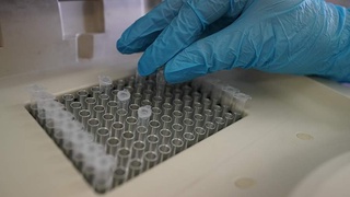 Olimlar viruslarni aniqlaydigan nanorobot ishlab chiqishdi