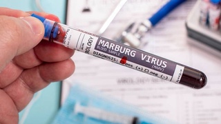 СУТ аз хатари эпидемияи ҷаҳонии вируси Марбург ҳушдор медиҳад