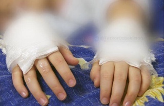 В Алмалыке задержана женщина, которая подожгла руки своему ребенку в качестве наказания