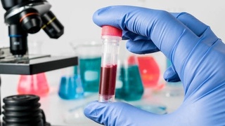 Еуропа мен АҚШ-та балалар  арасында  белгісіз  дерт  тарай  бастады