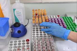 Chekish COVID-19ga qarshi emlashdan keyin antitanacha darajasini pasaytiradi