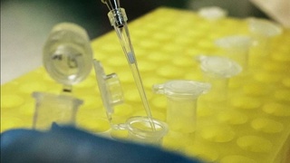 Toʻrt daqiqada koronavirusni aniqlab beruvchi qurilma ixtiro qilindi