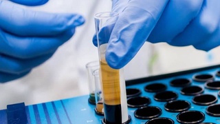 Ученые рассказали, каким будет новое поколение вакцин против COVID-19