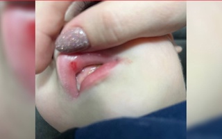 Toshkentdagi bogʻchalarning birida tarbiyachi bolaga shippak uloqtirdi