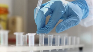 “COVID-19”га нодавлат тиббиёт муассасаларида ҳам таҳлил топшириш мумкин