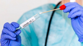 Koronavirusga bir kunda oʻrtacha 10 mingta PZR-test topshirilmoqda