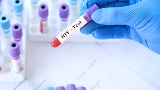 Dunyo bo'yicha beshinchi odam OIVdan butunlay davolandi