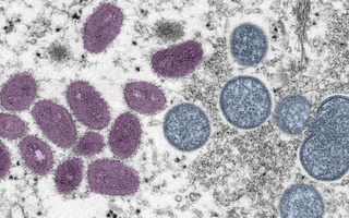 Африкада маймун чечаги туфайли фавқулодда ҳолат эълон қилинди