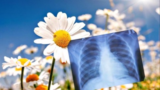 24 марта - Всемирный день борьбы с туберкулезом