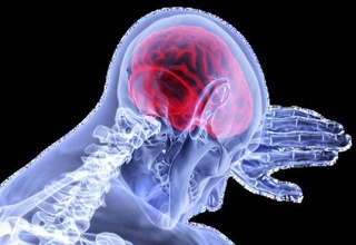 Опаснее, чем думали: обезьянья оспа оказалась способна поражать мозг