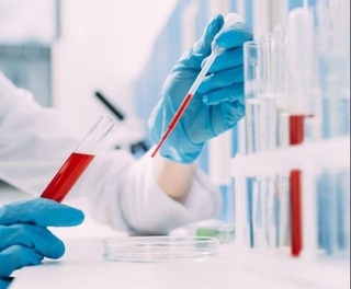 Qandli diabetga chalinganlarda buyrak yetishmovchiligining rivojlanishini sekinlashtirish yoʻli topildi