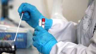 «Омикрон» штами хавфсиз экани рад этилди