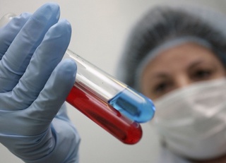 Чет элда 90 кундан ортиқ бўлиб қайтган ўзбекистонликларни ОИВга мажбурий равишда текширувдан ўтказиш таклиф қилинди