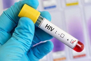 Процесс медицинского обследования на ВИЧ-инфекцию лиц, вступающих в брак, будет электронизирован