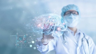 Найден способ лечения болезни Альцгеймера на ранней стадии