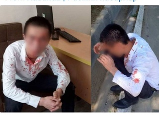 Ўқитувчини калтаклаганларга нисбатан жиноят иши қўзғатилди