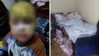 Qashqadaryoda tarbiyachi bolaning boshiga qaynoq suv toʻkib yubordi