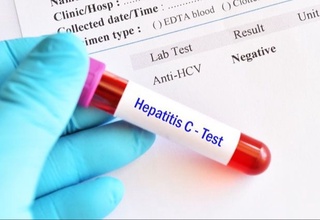 Virusli gepatitni aniqlash uchun bepul skrining tekshiruvlari oʻtkazilmoqda — SSV