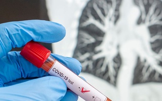 В Ферганской области выздоровел последний пациент