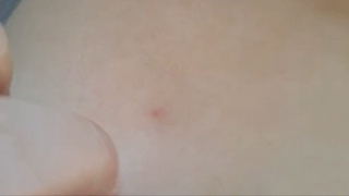 Bolalar bogʻchasida amaliyot oʻtayotgan kollej talabasi bogʻcha tarbiyalanuvchilariga igna tiqdi