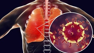 Коронавирус асоратлари ўпка учун қанчалик хавфли?