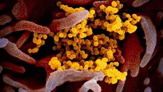 АҚШлик олимлар коронавирусга қарши самарали антитаначаларни аниқлади