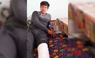 Икки ўқувчини уриб, жароҳат етказган директор ўринбосарига маъмурий иш қўзғатилди